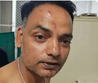 Chhindwara Crime: चाय की दुकान पर विवाद रोकने पहुंचे SAF आरक्षक पर चाकू से हमला, आरोपी गिरफ्तार